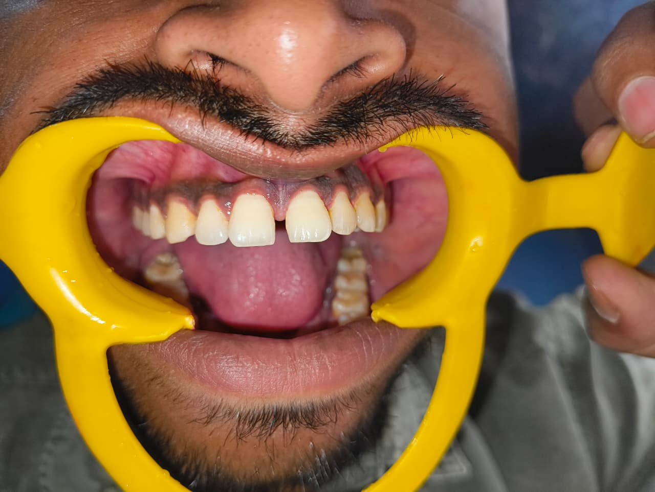 My Dentist dental case gallery photo 1