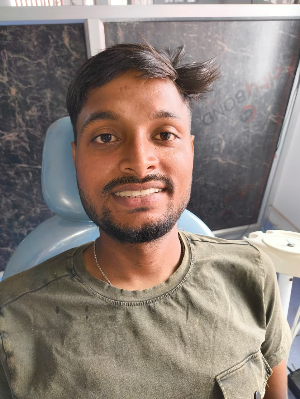 My Dentist dental case gallery photo 2