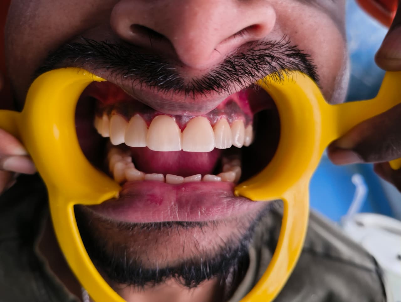 My Dentist dental case gallery photo 3