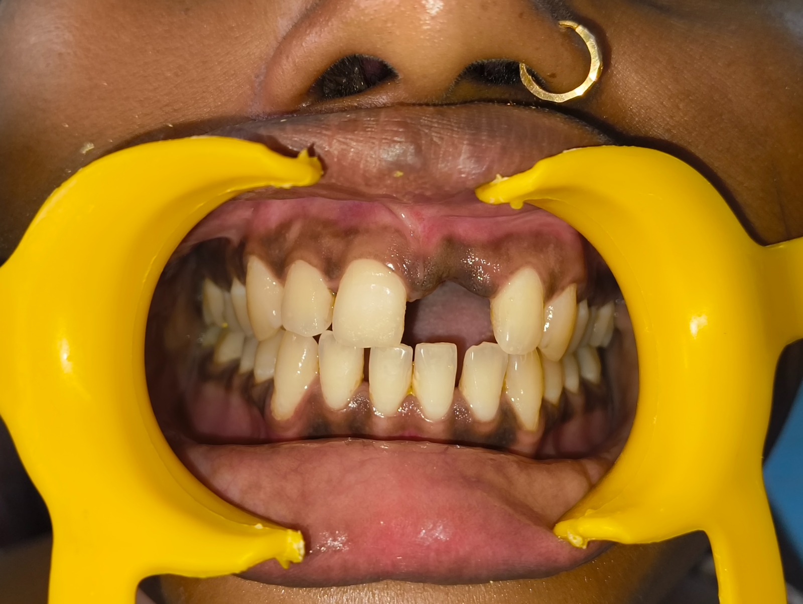 My Dentist dental case gallery photo 7