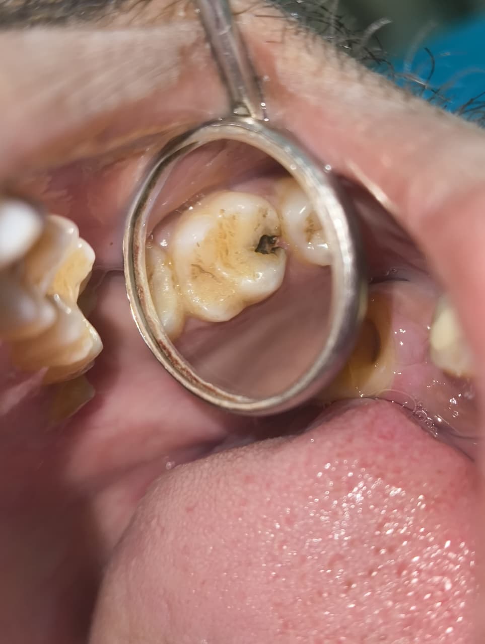 My Dentist dental case gallery photo 8