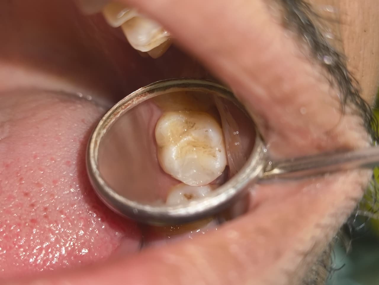 My Dentist dental case gallery photo 10