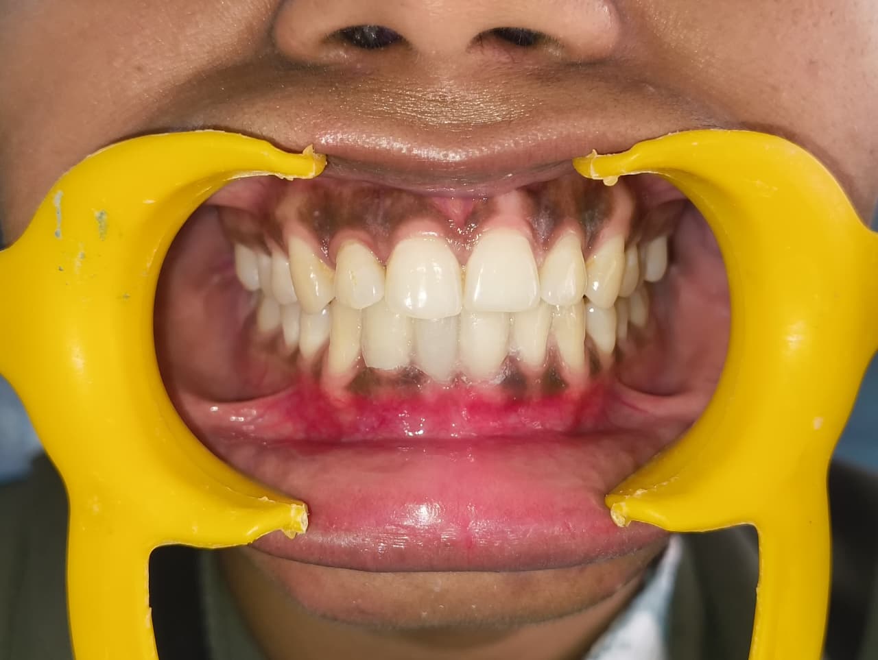 My Dentist dental case gallery photo 11
