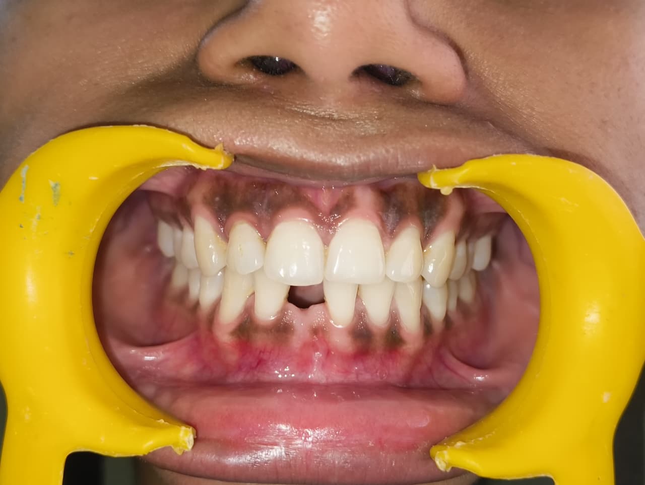My Dentist dental case gallery photo 12